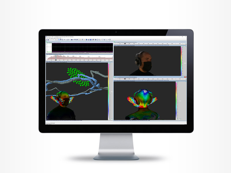 Einfache Erzeugung von 3D-Modellen